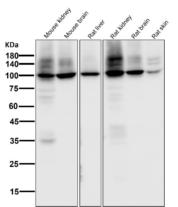 1 - Anti-Sodium Potassium ATPase ATP1A1 Rabbit Monoclonal Antibody ABO14296