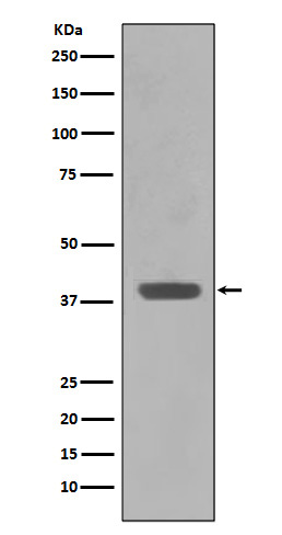 1 - Anti-Maltose Binding Protein malE Rabbit Monoclonal Antibody ABO14297