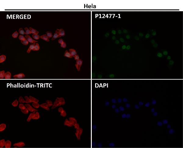 1 - Anti-Histone H3 (acetyl K56) HIST1H3A Rabbit Monoclonal Antibody ABO14298