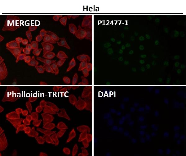 1 - Anti-Histone H3 (acetyl K56) HIST1H3A Rabbit Monoclonal Antibody ABO14298