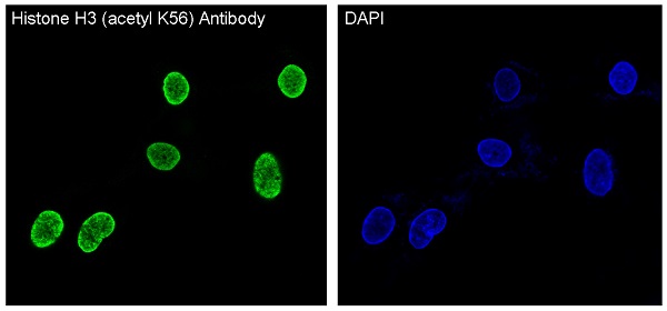 3 - Anti-Histone H3 (acetyl K56) HIST1H3A Rabbit Monoclonal Antibody ABO14298