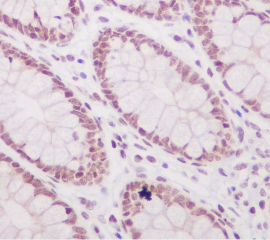 2 - Anti-Histone H3 (acetyl K56) HIST1H3A Rabbit Monoclonal Antibody ABO14298
