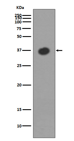 1 - Anti-Maltose Binding Protein malE Rabbit Monoclonal Antibody ABO14301