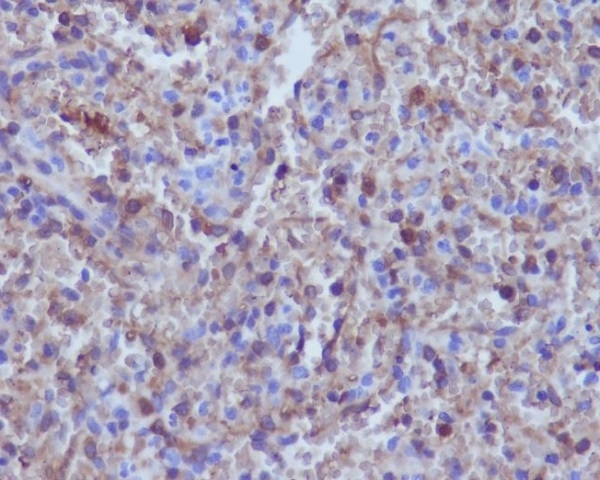 1 - Anti-Hemoglobin subunit alpha HBA1 Rabbit Monoclonal Antibody ABO14302