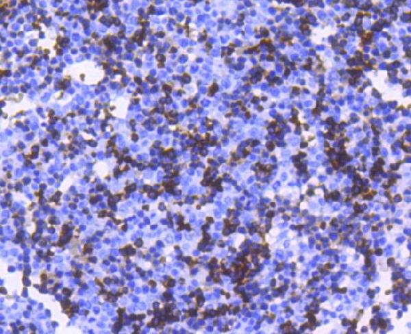 2 - Anti-Hemoglobin subunit alpha HBA1 Rabbit Monoclonal Antibody ABO14302