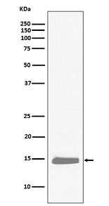 1 - Anti-Hemoglobin subunit alpha HBA1 Rabbit Monoclonal Antibody ABO14302