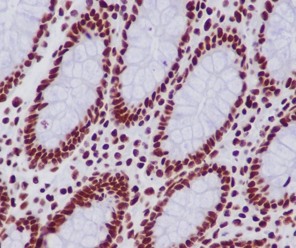 2 - Anti-Histone H2B (acetyl K20) HIST1H2BB Rabbit Monoclonal Antibody ABO14303