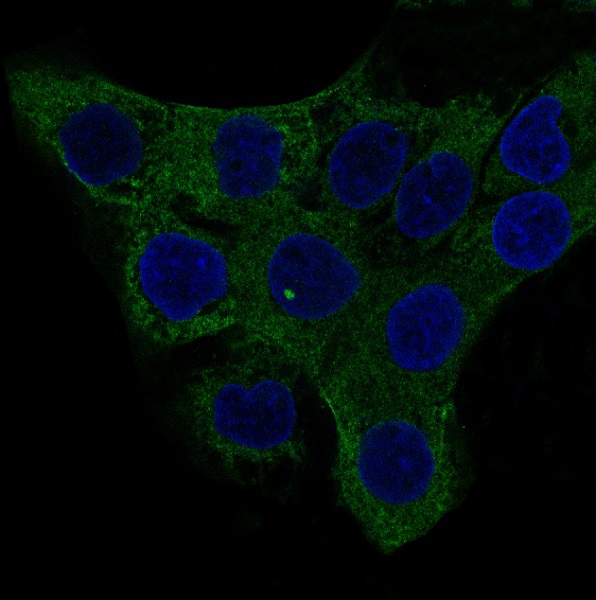 3 - Anti-alpha smooth muscle Actin ACTA2 Rabbit Monoclonal Antibody ABO14304