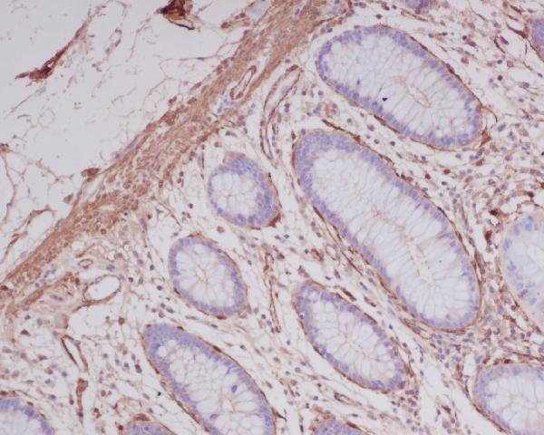 2 - Anti-alpha smooth muscle Actin ACTA2 Rabbit Monoclonal Antibody ABO14304