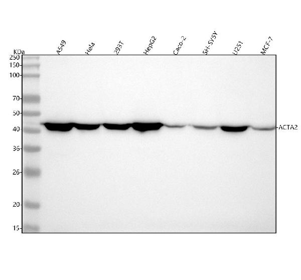 1 - Anti-alpha smooth muscle Actin ACTA2 Rabbit Monoclonal Antibody ABO14304