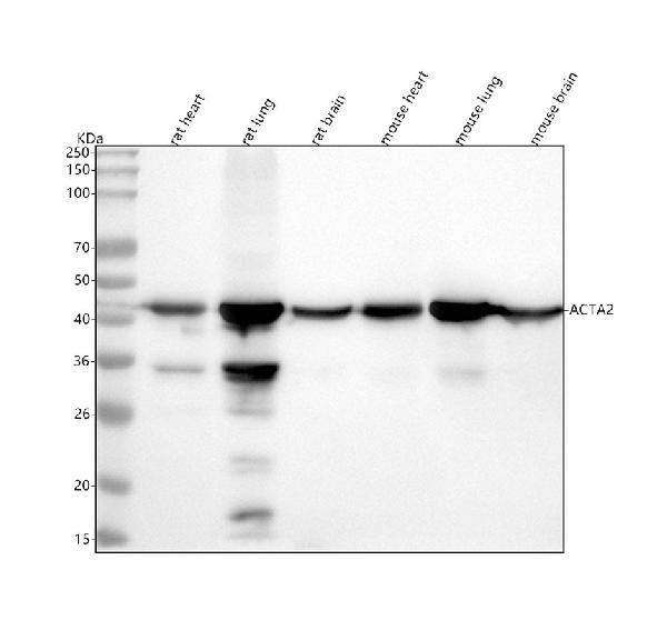 1 - Anti-alpha smooth muscle Actin ACTA2 Rabbit Monoclonal Antibody ABO14304