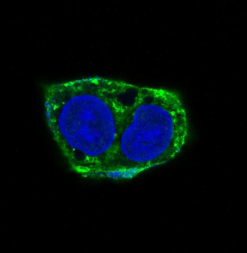 3 - Anti-alpha smooth muscle Actin ACTA2 Rabbit Monoclonal Antibody ABO14305