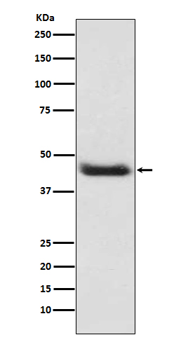 1 - Anti-alpha smooth muscle Actin ACTA2 Rabbit Monoclonal Antibody ABO14305