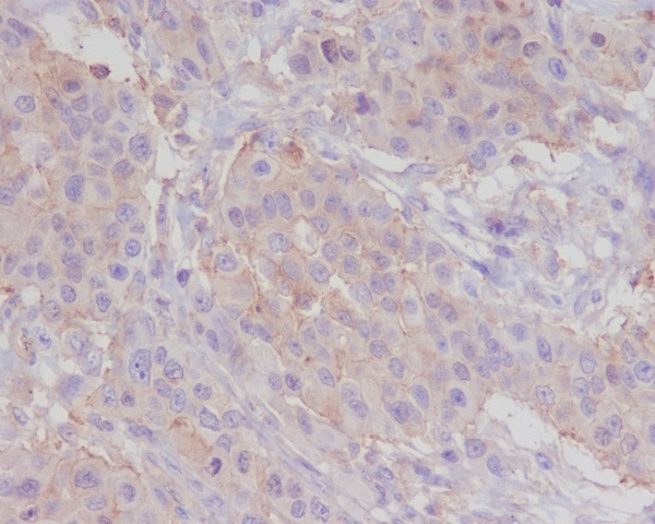2 - Anti-alpha smooth muscle Actin ACTA2 Rabbit Monoclonal Antibody ABO14307