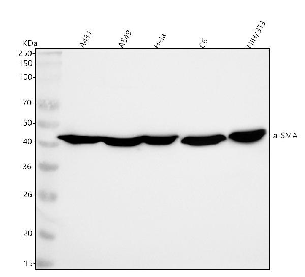 1 - Anti-alpha smooth muscle Actin ACTA2 Rabbit Monoclonal Antibody ABO14307