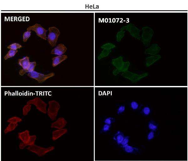1 - Anti-alpha smooth muscle Actin ACTA2 Rabbit Monoclonal Antibody ABO14307