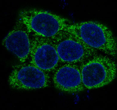 3 - Anti-alpha smooth muscle Actin ACTA2 Rabbit Monoclonal Antibody ABO14307