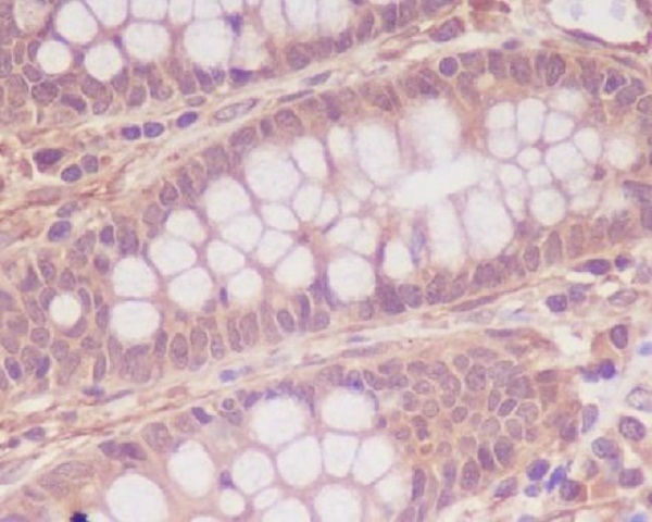 2 - Anti-Myosin light chain kinase MYLK Rabbit Monoclonal Antibody ABO14308