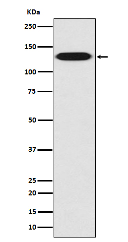 1 - Anti-Myosin light chain kinase MYLK Rabbit Monoclonal Antibody ABO14308