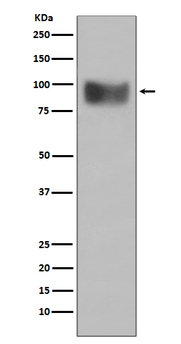 1 - Anti-Interferon Receptor alpha IFNAR1 Rabbit Monoclonal Antibody ABO14310