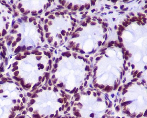 2 - Anti-Histone H2A (hydroxyl Y39) HIST1H2AB Rabbit Monoclonal Antibody ABO14311