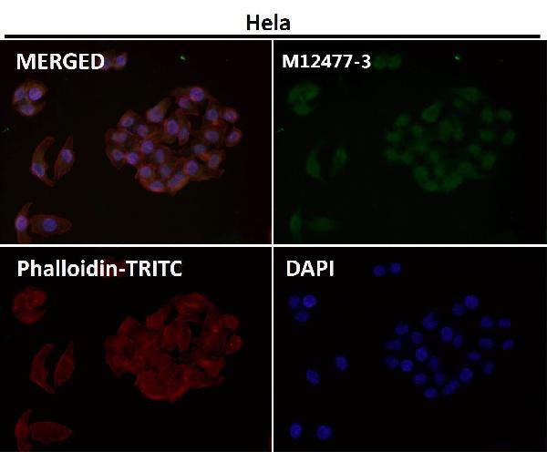 1 - Anti-Histone H3 (mono methyl R2) HIST1H3A Rabbit Monoclonal Antibody ABO14313