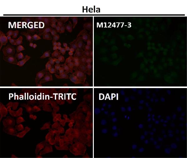 1 - Anti-Histone H3 (mono methyl R2) HIST1H3A Rabbit Monoclonal Antibody ABO14313