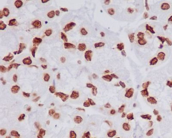 2 - Anti-Histone H4 (tri methyl K20) HIST1H4A Rabbit Monoclonal Antibody ABO14314