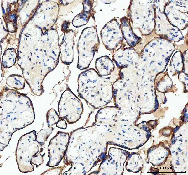 2 - Anti-Transferrin Receptor (CD71) TFRC Rabbit Monoclonal Antibody ABO14315