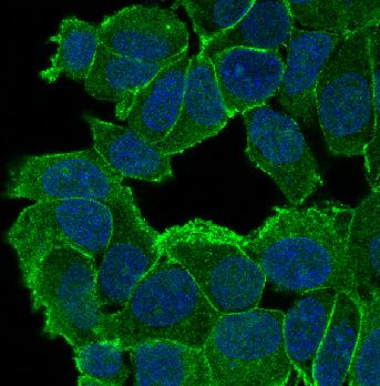 3 - Anti-delta 1 Catenin/p120 Catenin Rabbit Monoclonal Antibody ABO14316