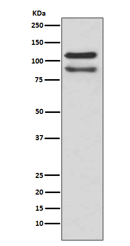 1 - Anti-delta 1 Catenin/p120 Catenin Rabbit Monoclonal Antibody ABO14316
