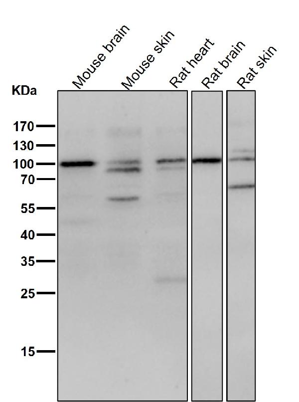1 - Anti-delta 1 Catenin/p120 Catenin Rabbit Monoclonal Antibody ABO14316