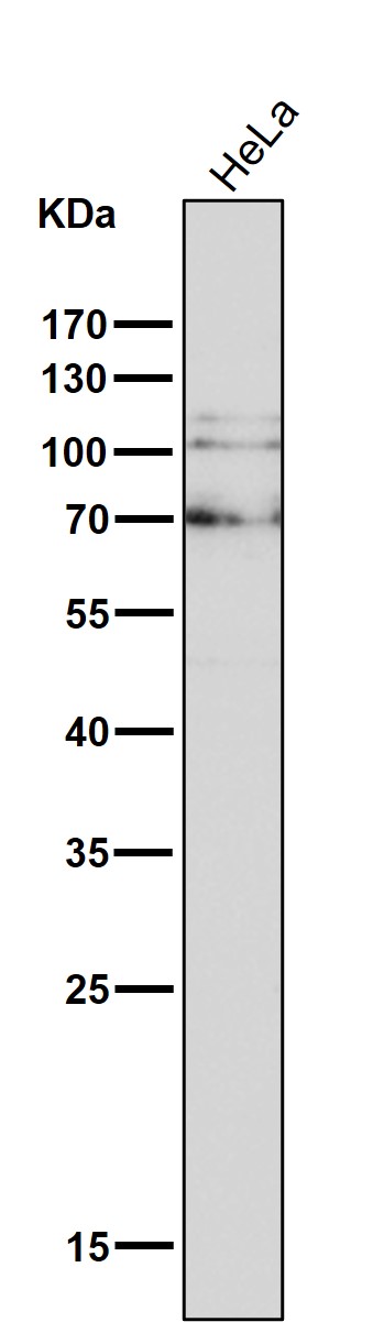 1 - Anti-delta 1 Catenin/p120 Catenin Rabbit Monoclonal Antibody ABO14316