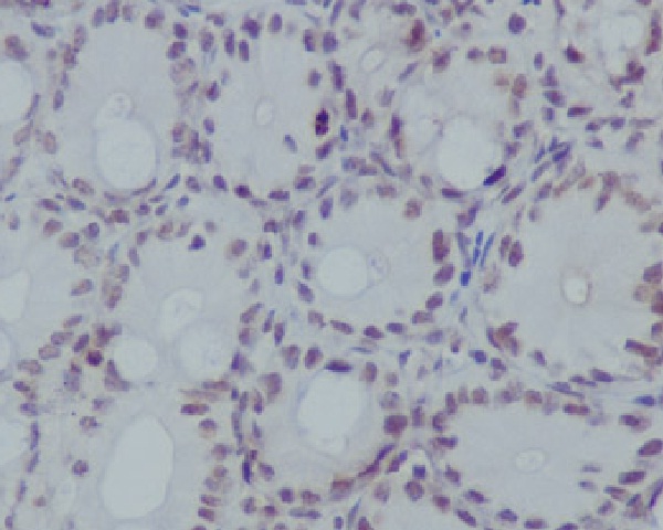 2 - Anti-Histone H3 (mono methyl R17) HIST1H3A Rabbit Monoclonal Antibody ABO14317