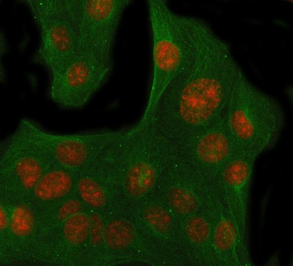 3 - Anti-Histone H3 (mono methyl K18) HIST1H3A Rabbit Monoclonal Antibody ABO14320