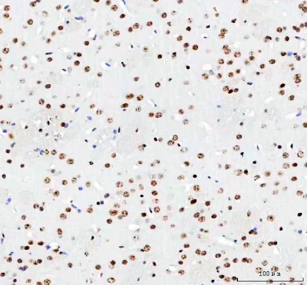 2 - Anti-Histone H3 (mono methyl K18) HIST1H3A Rabbit Monoclonal Antibody ABO14320