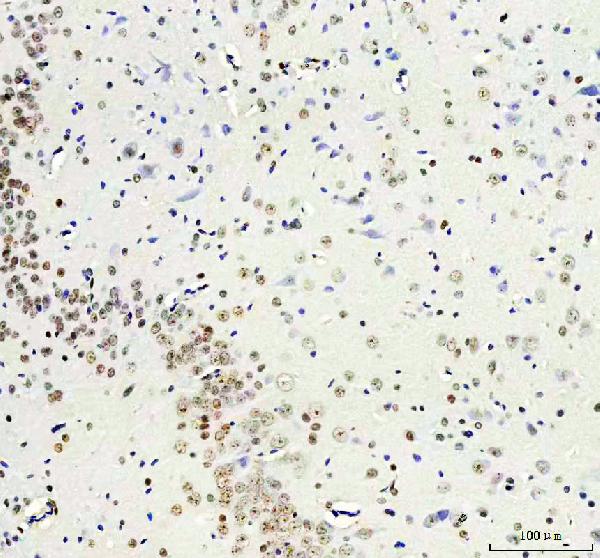 2 - Anti-Histone H3 (mono methyl K18) HIST1H3A Rabbit Monoclonal Antibody ABO14320