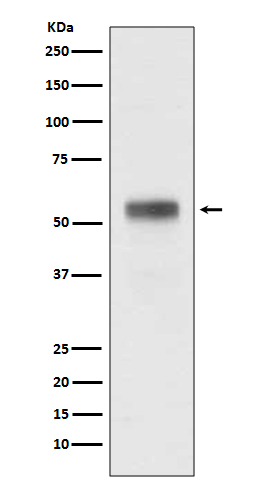1 - Anti-Retinoic Acid Receptor alpha RARA Rabbit Monoclonal Antibody ABO14321
