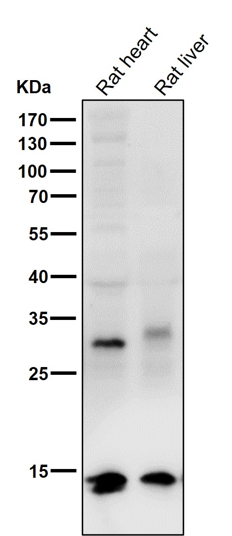 1 - Anti-Retinoic Acid Receptor alpha RARA Rabbit Monoclonal Antibody ABO14321