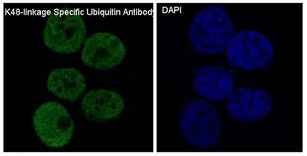3 - Anti-K48-linkage Specific Ubiquitin UBB Rabbit Monoclonal Antibody ABO14325