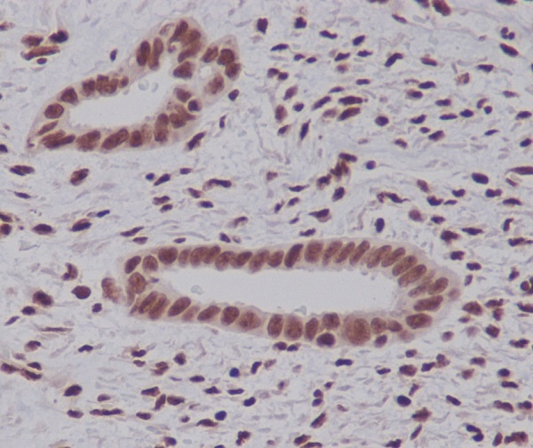 2 - Anti-K48-linkage Specific Ubiquitin UBB Rabbit Monoclonal Antibody ABO14325