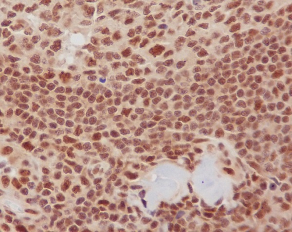 2 - Anti-K63-linkage Specific Ubiquitin UBB Rabbit Monoclonal Antibody ABO14326