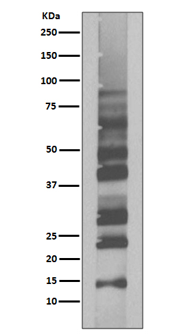 1 - Anti-K63-linkage Specific Ubiquitin UBB Rabbit Monoclonal Antibody ABO14326