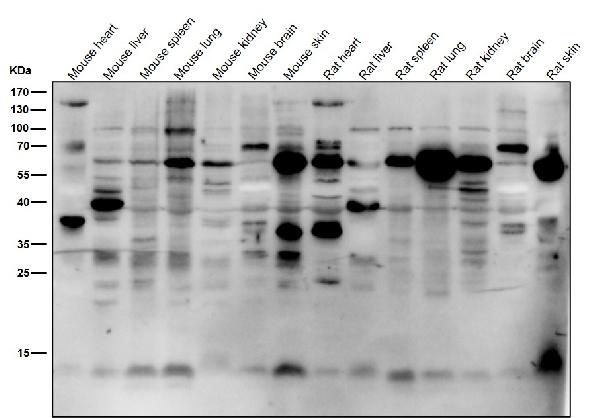 1 - Anti-K63-linkage Specific Ubiquitin UBB Rabbit Monoclonal Antibody ABO14326