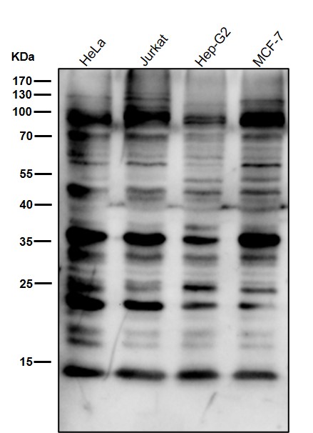 1 - Anti-K63-linkage Specific Ubiquitin UBB Rabbit Monoclonal Antibody ABO14326