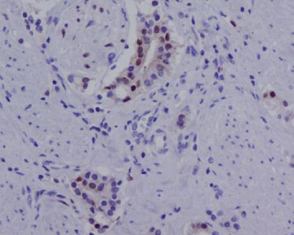 2 - Anti-Androgen Receptor (AR-V7 specific) Rabbit Monoclonal Antibody ABO14327