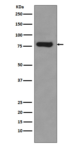 1 - Anti-Androgen Receptor (AR-V7 specific) Rabbit Monoclonal Antibody ABO14327