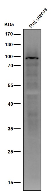 1 - Anti-Androgen Receptor (AR-V7 specific) Rabbit Monoclonal Antibody ABO14327