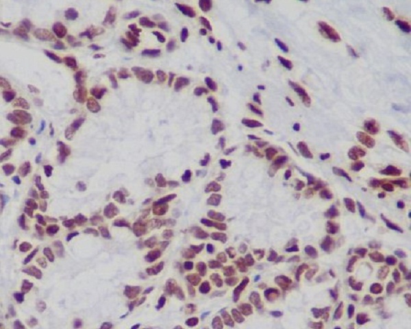2 - Anti-Histone H3 (mono+di+tri methyl K79) HIST1H3A Rabbit Monoclonal Antibody ABO14328