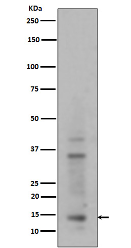 1 - Anti-Histone H3 (mono+di+tri methyl K14) HIST1H3A Rabbit Monoclonal Antibody ABO14329